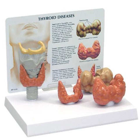 Thyroid Disorders Model - 054a5bd13bae74af10a048e97e78f96d
