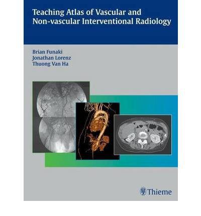 Teaching Atlas of Vascular and Non-Vascular Interventional Radiology - 086f204ca7757f611f524dee738de048