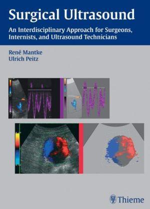 Surgical Ultrasound - 0bfcb9419477c72526ca8ad8a35854d6