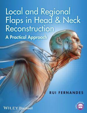 Local and Regional Flaps in Head & Neck Reconstruction: A Practical Approach - 0c0de6a07845e1d72d26975db79e23cc