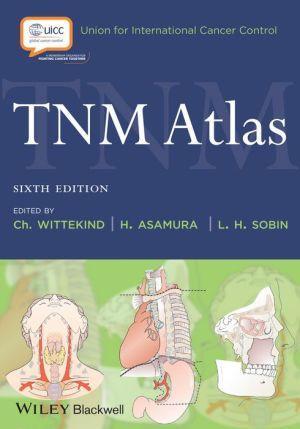 TNM Atlas - 122591bf84ceb90c562b0d798c49aebf
