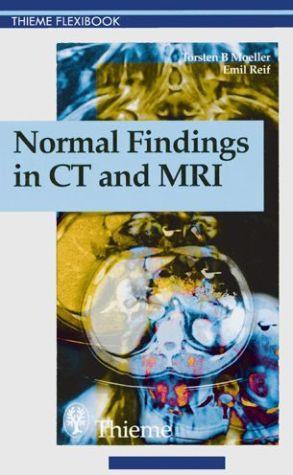Normal Findings in CT and MRI - 16a034de9baecb091c0ac4d21f71fbd3