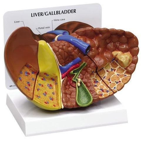 Liver Cancer Model - normal + 3 conditions - 1d1d25b8ad6f5ffa66a40651e6844e4e