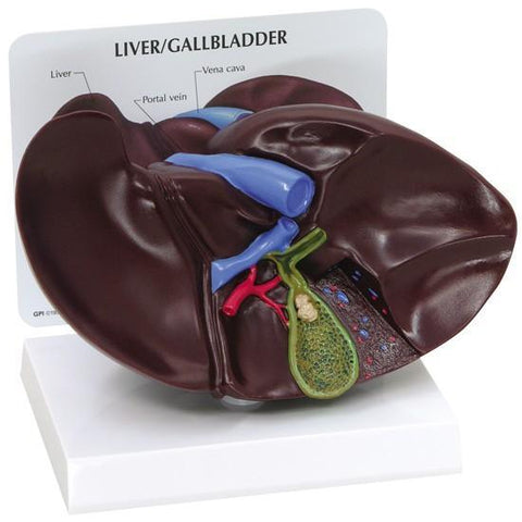 Liver/Gallbladder Model with gallstones - 1f74df403598a8222828e0820afc44c4