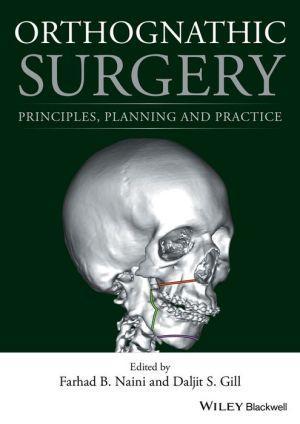 Orthognathic Surgery - Principles, Planning and Practice - 20e6cb9a5dc010efa806b5a367e90116