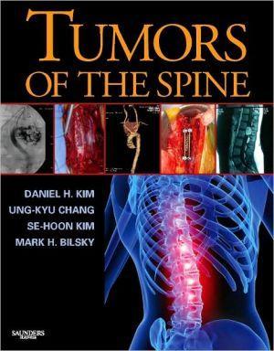 Tumors of the Spine ** - 232040fa620d766ecc2820f807456deb