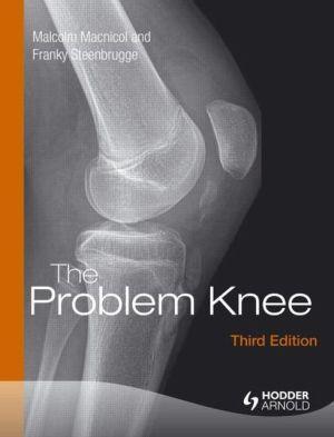The Problem Knee, 3e - 2ba292e9756a3576197876263a74daa2