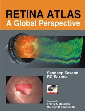 Retina Atlas: A Global Perspective - 304bb0d3afbf80dcc9aa7f0ecf6f885b