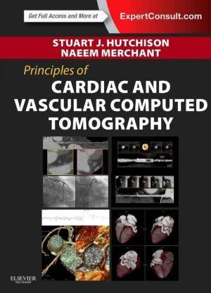 Principles of Cardiac and Vascular Computed Tomography - 382d0636dfc10e910835b83189fd0817