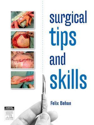 Surgical Tips and Skills - 3a20288da9be9b6b82a806c1b4254858