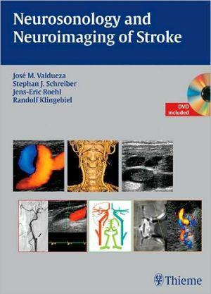 Neurosonology and Neuroimaging of Stroke, Book & DVD - 3c8220ef5e9f0622e39bc33377ce9d53