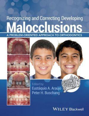 Recognizing and Correcting Developing Malocclusions: A Problem-Oriented Approach to Orthodontics - 3cb3aee32ab9bb605e6181d16f841b00