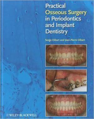 Practical Osseous Surgery in Periodontics and Implant Dentistry - 3d1569539cc6633be541fd83aeddea08