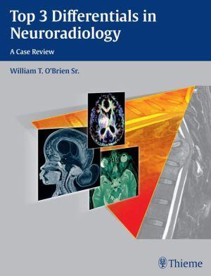 Top 3 Differentials in Neuroradiology - 3d9e746f5de1d86a6fb9acb0462139a6