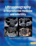 Ultrasonography in Reproductive Medicine and Infertility - 3e24cf0e03b3fbc298d6f1b9622dd562