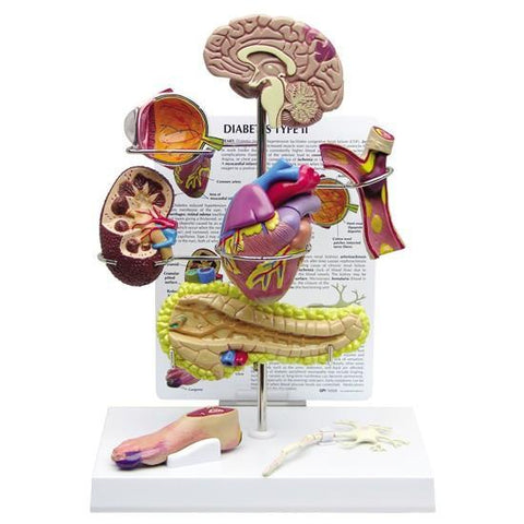 Type-2 Diabetes Set Model: Brain, Eye, Heart, Kidney, Artery, Pancreas, Foot, Nerve - 4497569914be2c068eac639b123b7d4f