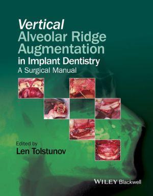 Vertical Alveolar Ridge Augmentation in Implant Dentistry - A Surgical Manual - 49f6ba87c919d273ef88ed5cca735eb8