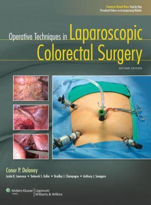 Operative Techniques in Laparoscopic Colorectal Surgery, 2e - 4d8a464743977040a2f29f8467a6938f