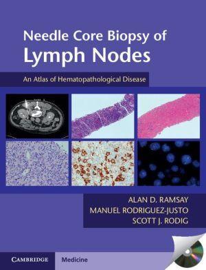 Needle Core Biopsy of Lymph Nodes with DVD-ROM - 4f781491f4ce879b6863e44c624808c9