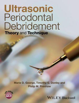 Ultrasonic Periodontal Debridement - Theory and Technique - 545bf6cd9e1bd0bd833df27c9dc1a414