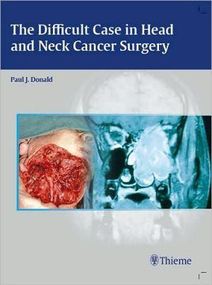 The Difficult Case in Head and Neck Cancer Surgery - 55517126c43f97ace1ebd4805de6aa16