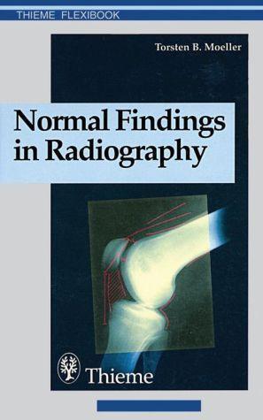 Normal Findings in Radiography - 5699cce3b2a528dbcb2b6d234a46650f