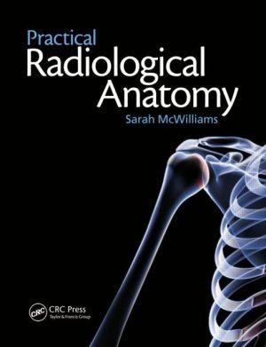 Practical Radiological Anatomy - 59f3fd554bf1a5a19682b2d1da54bdc3