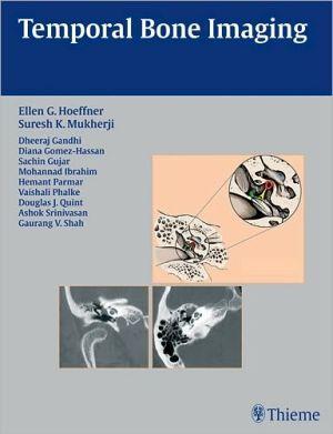Temporal Bone Imaging - 5af47ad29ef9126cecac132a2f3090b6