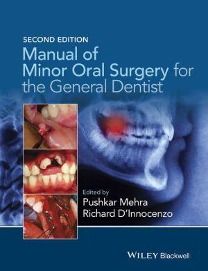 Manual of Minor Oral Surgery for the General Dentist, Second Edition - 5b6f651eab295122967894c36ed5ba44