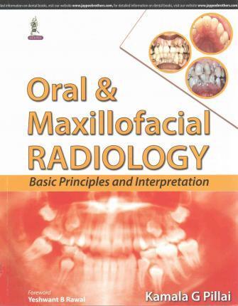 Oral and Maxillofacial Radiology: Basic Principles and Interpretation - 5fd7249707f033e555b4844f9ce6ff1a
