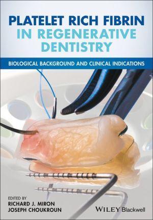 Platelet Rich Fibrin in Regenerative Dentistry: Biological Background and Clinical Indications - 6be61953ca1489e986bc1a4529b8f747