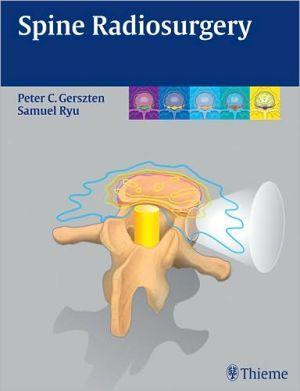 Spine Radiosurgery - 74f7c6be0e0d8a104064c663aba90e54