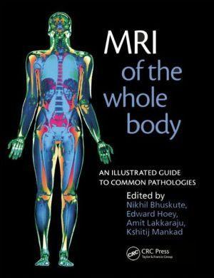 MRI of the Whole Body - 75302afc9cb75a9fdb07437684d73fb9