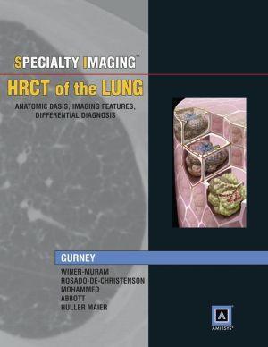 Specialty Imaging™: HRCT of the Lung ** - 75c623edde8f5249157fb53c6a10e2cb