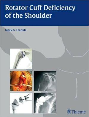 Rotator Cuff Deficiency of the Shoulder - 76b824cfb808798b1205622a7bdac138