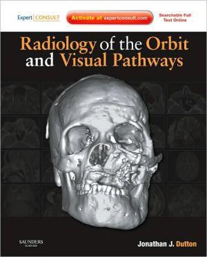 Radiology of the Orbit and Visual Pathways - 77736c7eefc60fe276d0cc81c8fc6062