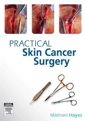 Practical Skin Cancer Surgery - 7a9c22ac216d3ca5727a456d0519e5ea