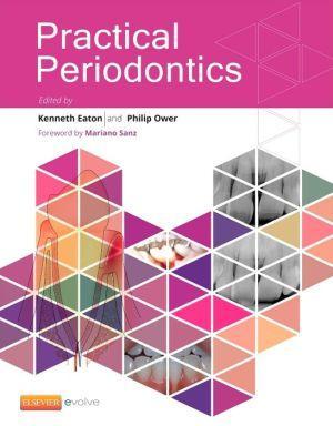 Practical Periodontics - 7de3c8ca90c3a77827e4b7df4bcac28c