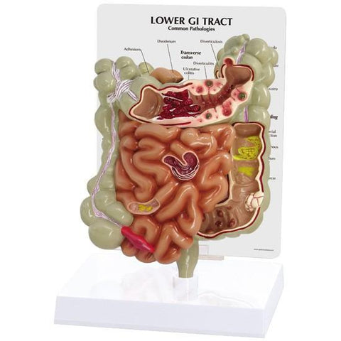 Lower GI Tract Model - 7f69303d98a0fcd95118099c3e28f60b