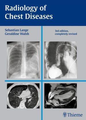 Radiology of Chest Diseases - 82d9e25aed43a5a77c8cb80c2ef5c433