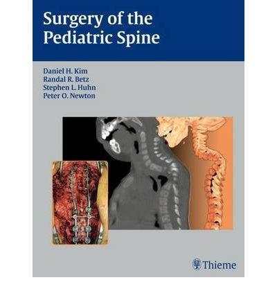 Surgery of the Pediatric Spine - 8a13cfae5052802daf1248e33b3cd690