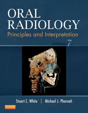 Oral Radiology, Principles and Interpretation, 7e - 95bb1e8624e0d88378289a1cccd1e61d