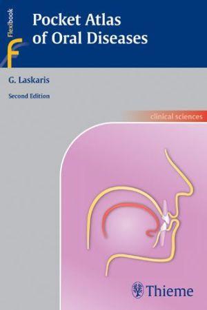 Pocket Atlas of Oral Diseases, 2e - 9618122b9b3a9ff4510b35c5ca86a299