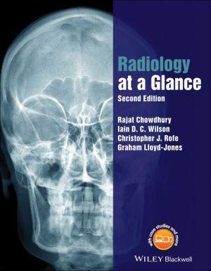 Radiology at a Glance, 2nd Edition - 9836af8f80b822247e70e7ce6d75cbc2