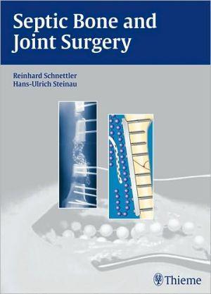 Septic Bone and Joint Surgery - 99cfd1aa12637e258ac696068341a751