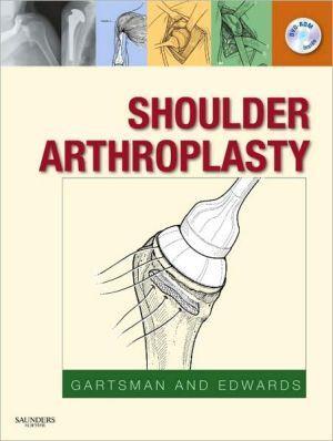 Shoulder Arthroplasty ** - 9d583e1a9eb2bcf138de028d8989d912
