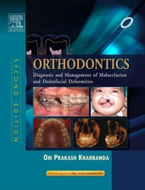 Orthodontics: Diagnosis and Management of Malocclusion and Dentofacial Deformities, 2/e - 9e84104b14eb22a0189b55d53965c2a8