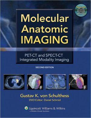 Molecular Anatomic Imaging, 2e ** - 9eac500fa01e9b20f981f1bb574da940