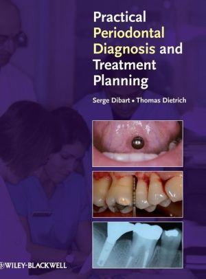 Practical Periodontal Diagnosis and Treatment Planning - a1c0e500d532e0940e5c419541aad899