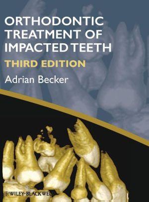 Orthodontic Treatment of Impacted Teeth, 3e - a244d4b9146de2d40f88352d8d92f0fa